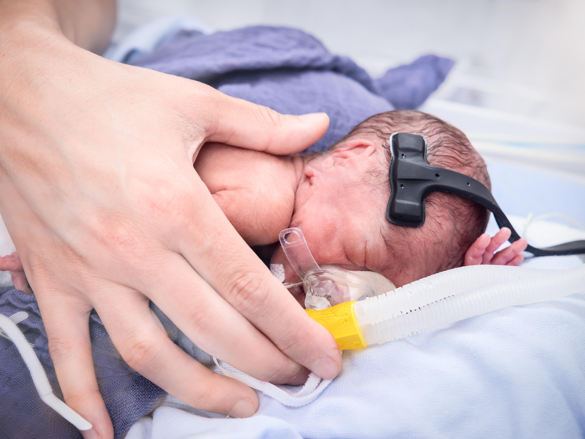 Baby with 2nd gen Oxyprem Sensor